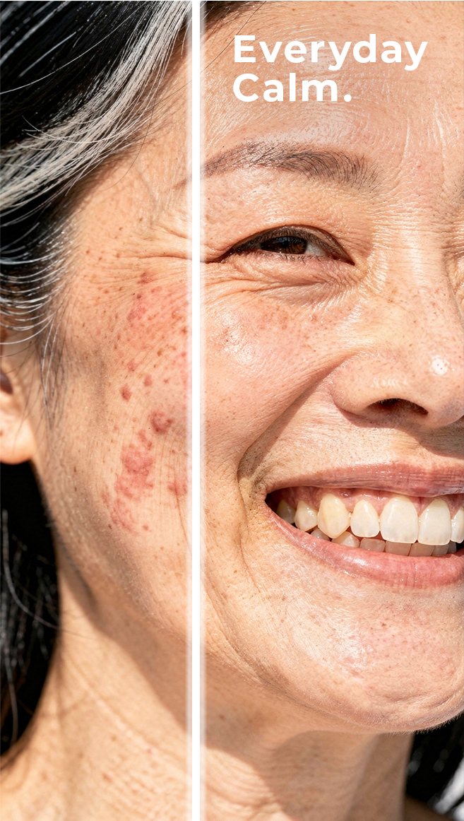 Split-face before/after macro beauty shot, Asian model