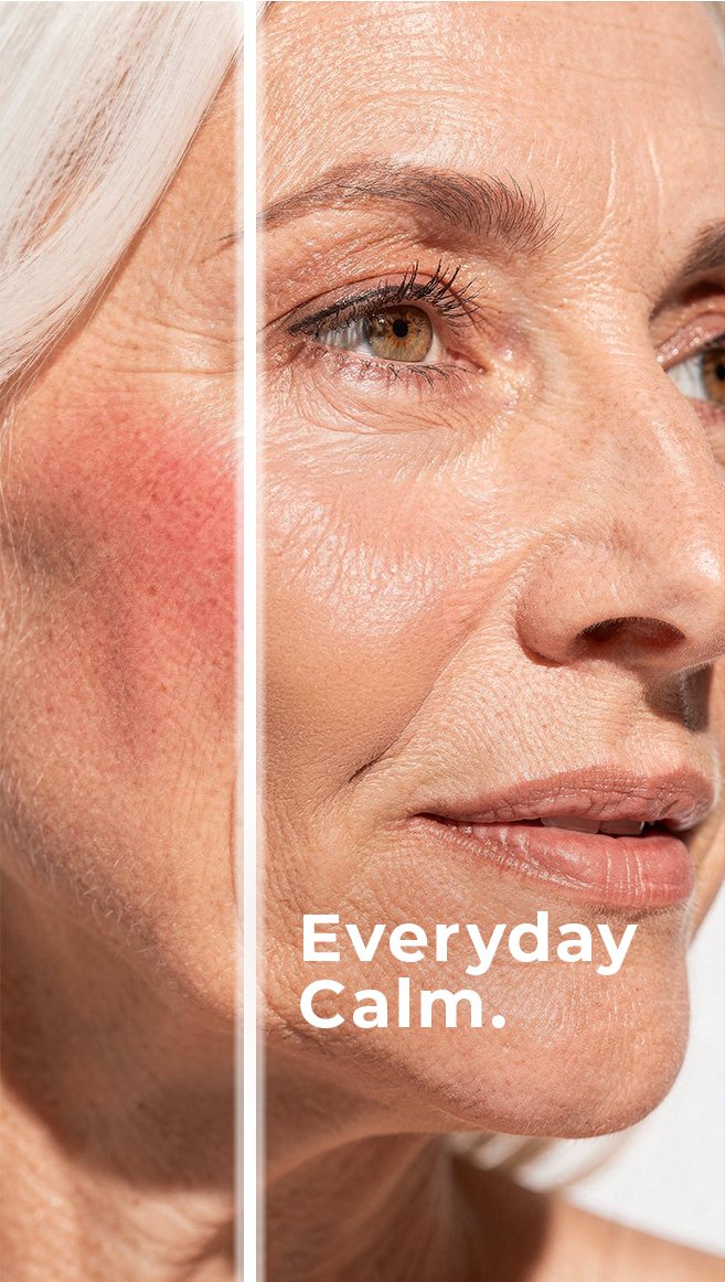 Split-face before/after macro beauty shot, Caucasian model