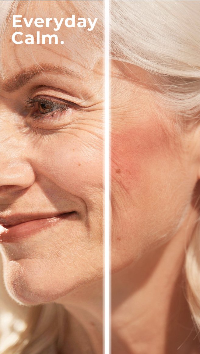 Split-face before/after, European model
