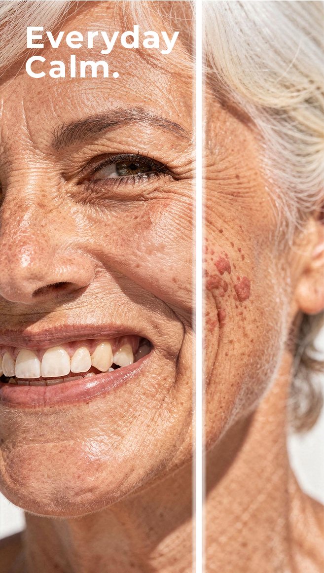 Split-face before/after macro beauty shot, Hispanic model